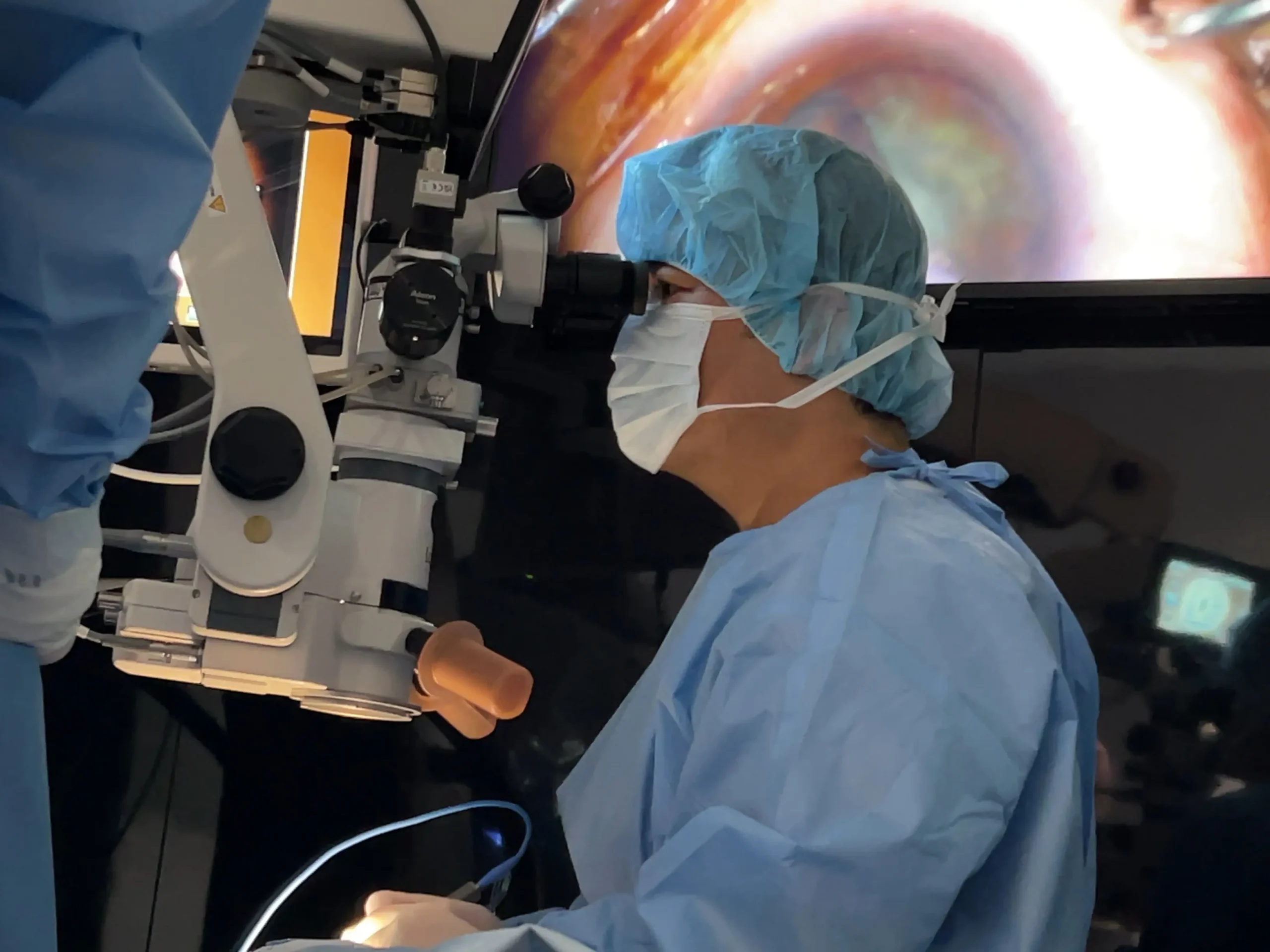 市原市・姉ヶ崎駅前眼科の院長が白内障手術を執刀している様子