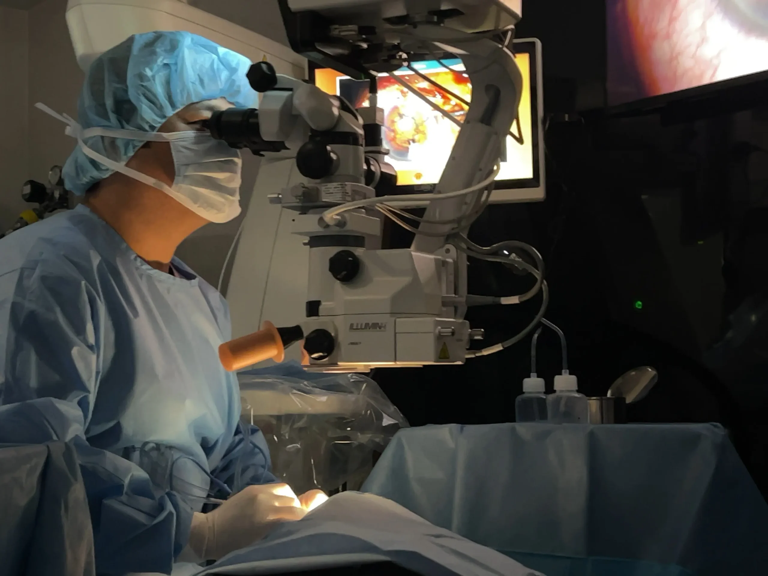 白内障手術中の姉ヶ崎駅前眼科院長と手術設備全景